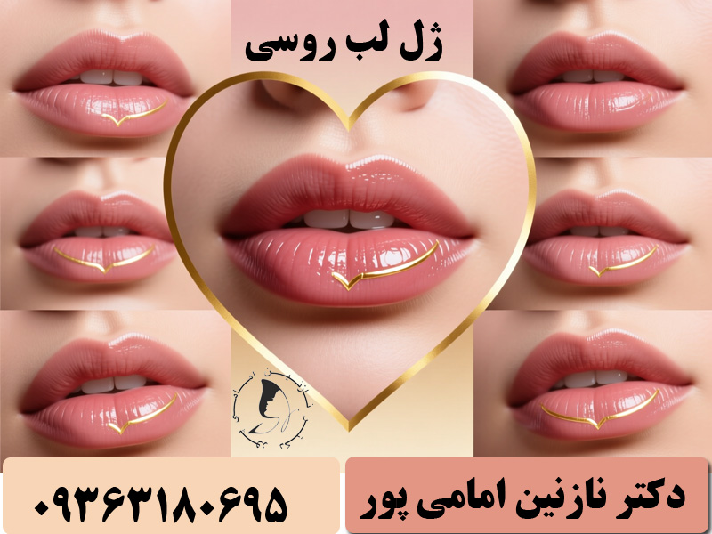 ژل لب روسی
