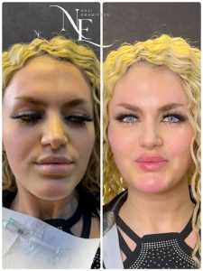 کانتورینگ صورت