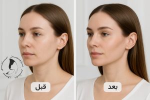 کانتورینگ صورت