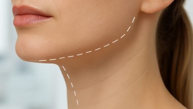 بهترین مدل زاويه سازی فک برای فرم های مختلف صورت