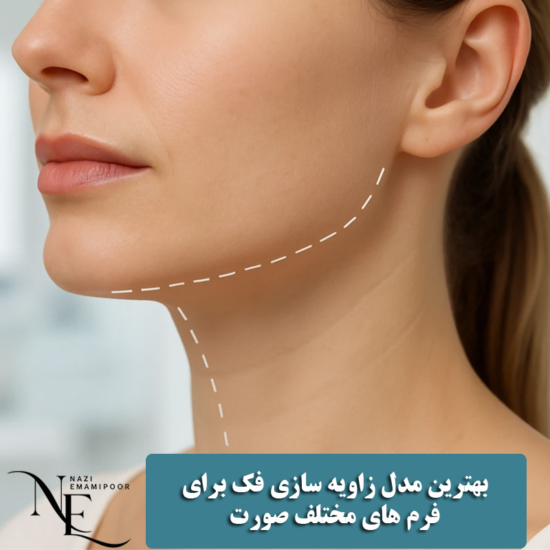 بهترین مدل زاويه سازی فک برای فرم های مختلف صورت