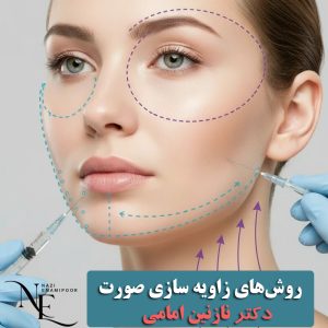 روش‌های زاویه سازی صورت